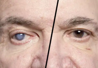 How to Prevent Cataract – Eye Care Tips from Vision Plus Optics Tambaram